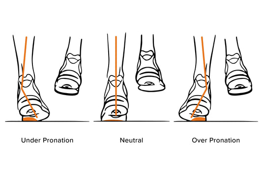 What is Gait Analysis - Everything You Need To Know – Up & Running